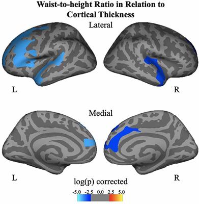 Prefrontal Cortex and Amygdala Subregion Morphology Are Associated With Obesity and Dietary Self-control in Children and Adolescents
